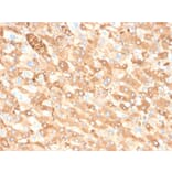 Immunohistochemistry - Anti-Albumin Antibody [ALB/6413R] (A248504) - Antibodies.com