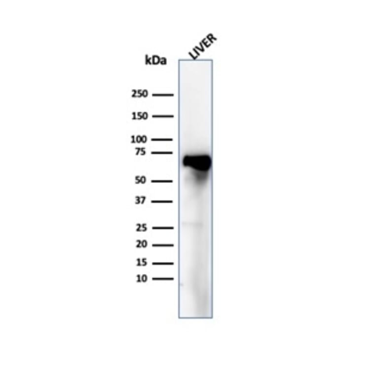 Western Blot - Anti-Albumin Antibody [ALB/6409R] (A248505) - Antibodies.com