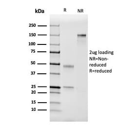 SDS-PAGE - Anti-Coagulation Factor VII Antibody [F7/3511] (A248507) - Antibodies.com