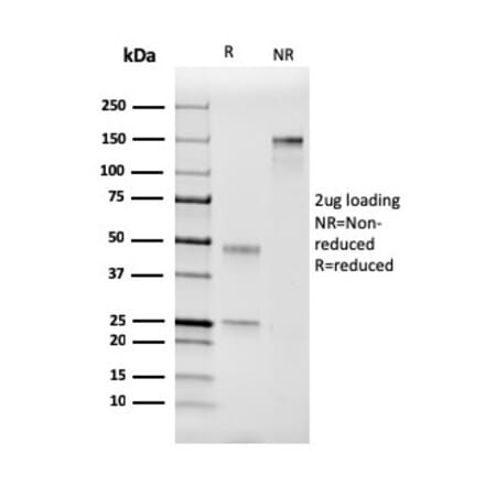 SDS-PAGE - Anti-Coagulation Factor VII Antibody [F7/3511] (A248507) - Antibodies.com