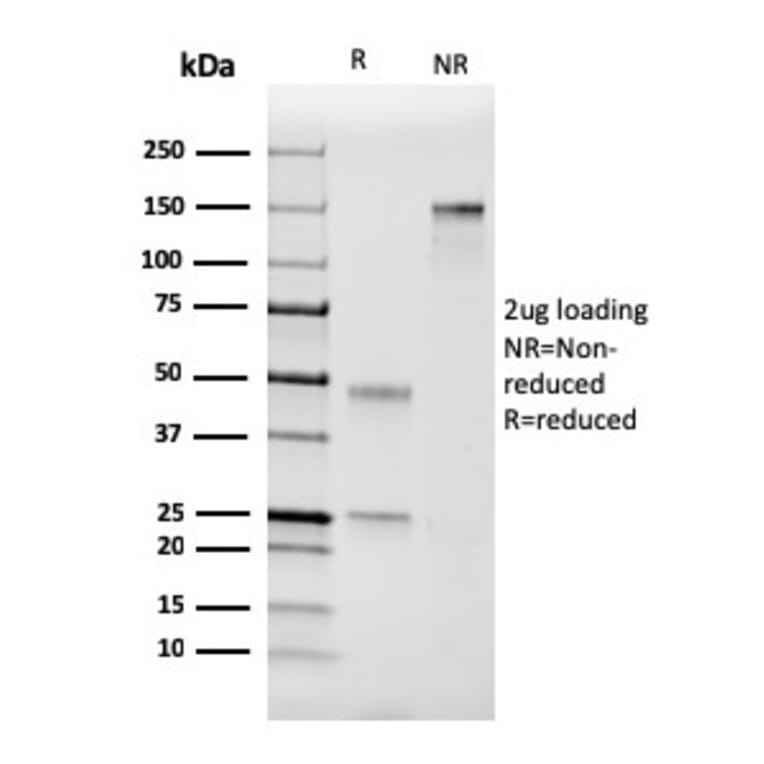 SDS-PAGE - Anti-Coagulation Factor VII Antibody [F7/3511] (A248507) - Antibodies.com