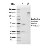 SDS-PAGE - Anti-Coagulation Factor VII Antibody [F7/3511] (A248507) - Antibodies.com