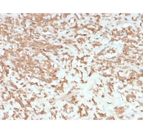 Immunohistochemistry - Anti-Coagulation Factor VII Antibody [F7/3513] (A248508) - Antibodies.com