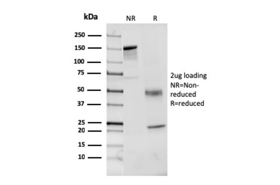 SDS-PAGE - Anti-Coagulation Factor VII Antibody [F7/3513] (A248508) - Antibodies.com