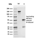 SDS-PAGE - Anti-Coagulation Factor VII Antibody [F7/3516] (A248509) - Antibodies.com
