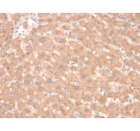 Immunohistochemistry - Anti-Coagulation Factor VII Antibody [F7/3618] (A248510) - Antibodies.com