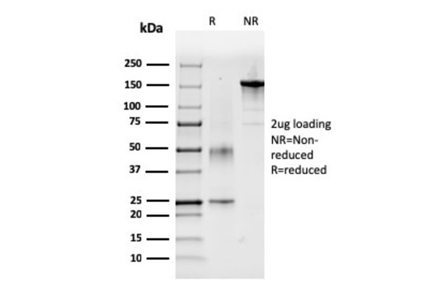 SDS-PAGE - Anti-Coagulation Factor VII Antibody [F7/3618] (A248510) - Antibodies.com