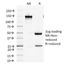 SDS-PAGE - Anti-Factor XIIIa Antibody [F13A1/1447] (A248510) - Antibodies.com