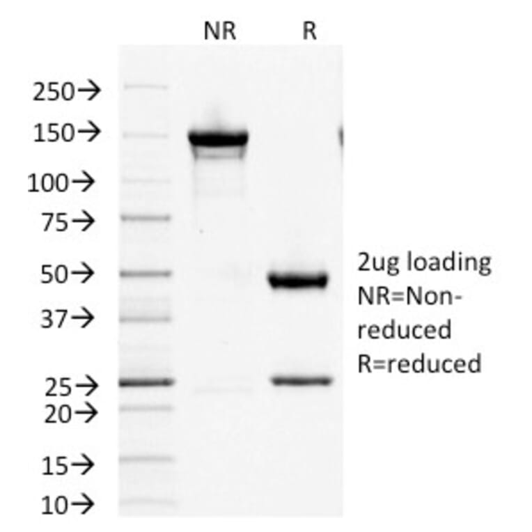 SDS-PAGE - Anti-Factor XIIIa Antibody [F13A1/1447] (A248510) - Antibodies.com