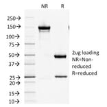 SDS-PAGE - Anti-Factor XIIIa Antibody [F13A1/1447] (A248510) - Antibodies.com