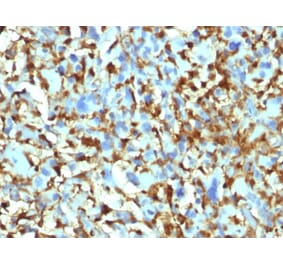 Immunohistochemistry - Anti-Factor XIIIa Antibody [F13A1/1448] (A248512) - Antibodies.com