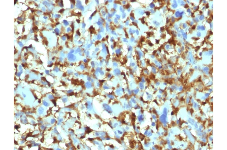 Immunohistochemistry - Anti-Factor XIIIa Antibody [F13A1/1448] (A248512) - Antibodies.com