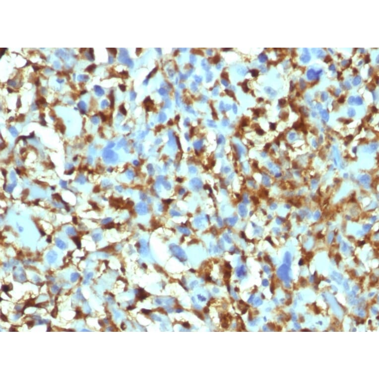 Immunohistochemistry - Anti-Factor XIIIa Antibody [F13A1/1448] (A248512) - Antibodies.com