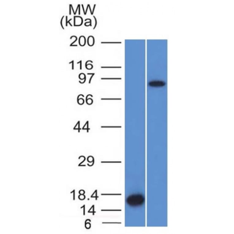 Western Blot - Anti-Factor XIIIa Antibody [F13A1/1448] (A248512) - Antibodies.com