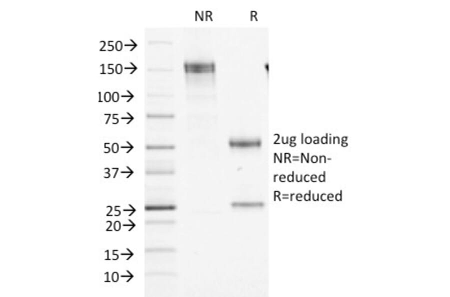 SDS-PAGE - Anti-Factor XIIIa Antibody [F13A1/1448] (A248512) - Antibodies.com