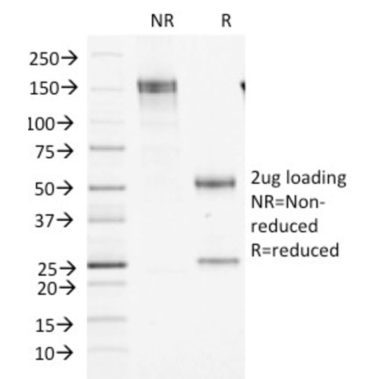 SDS-PAGE - Anti-Factor XIIIa Antibody [F13A1/1448] (A248512) - Antibodies.com
