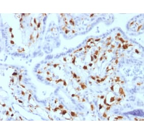 Immunohistochemistry - Anti-Factor XIIIa Antibody [SPM180] (A248512) - Antibodies.com