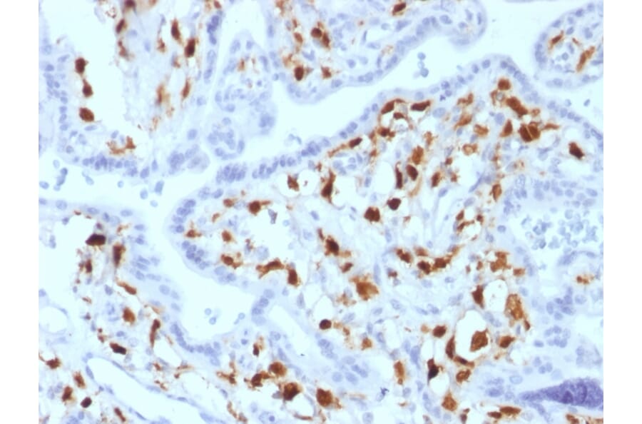 Immunohistochemistry - Anti-Factor XIIIa Antibody [SPM180] (A248512) - Antibodies.com