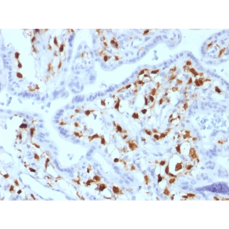 Immunohistochemistry - Anti-Factor XIIIa Antibody [SPM180] (A248512) - Antibodies.com