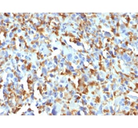 Immunohistochemistry - Anti-Factor XIIIa Antibody [F13A1/1683] (A248514) - Antibodies.com