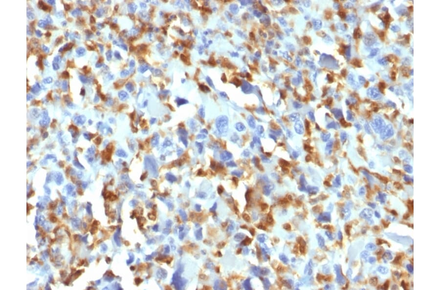 Immunohistochemistry - Anti-Factor XIIIa Antibody [F13A1/1683] (A248514) - Antibodies.com