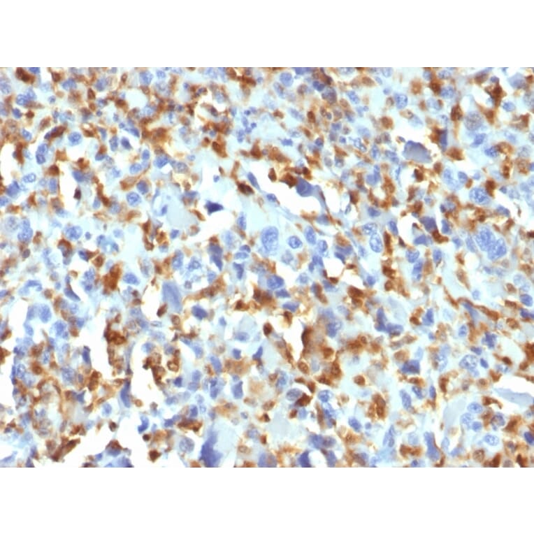 Immunohistochemistry - Anti-Factor XIIIa Antibody [F13A1/1683] (A248514) - Antibodies.com