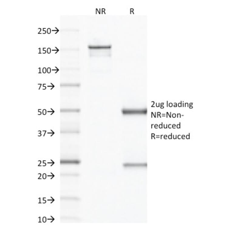 SDS-PAGE - Anti-Factor XIIIa Antibody [F13A1/1683] (A248514) - Antibodies.com