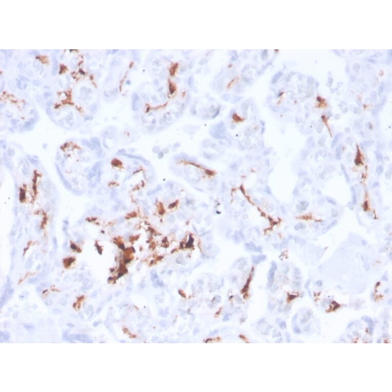 Immunohistochemistry - Anti-Factor XIIIa Antibody [F13A1/3772R] (A248515) - Antibodies.com