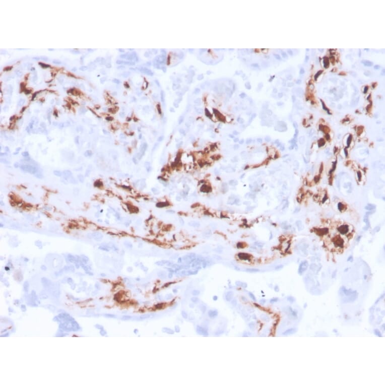 Immunohistochemistry - Anti-Factor XIIIa Antibody [F13A1/3772R] (A248514) - Antibodies.com