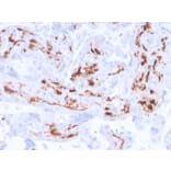 Immunohistochemistry - Anti-Factor XIIIa Antibody [F13A1/3772R] (A248514) - Antibodies.com