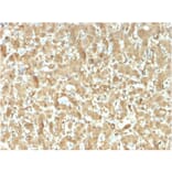 Immunohistochemistry - Anti-FABP1 Antibody [FABP1/3482] (A248516) - Antibodies.com