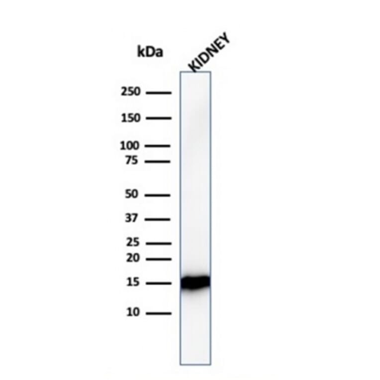Western Blot - Anti-FABP1 Antibody [FABP1/3482] (A248516) - Antibodies.com