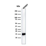 Western Blot - Anti-FABP1 Antibody [FABP1/3482] (A248516) - Antibodies.com