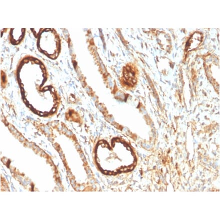 Immunohistochemistry - Anti-FABP1 Antibody [FABP1/3483] (A248517) - Antibodies.com