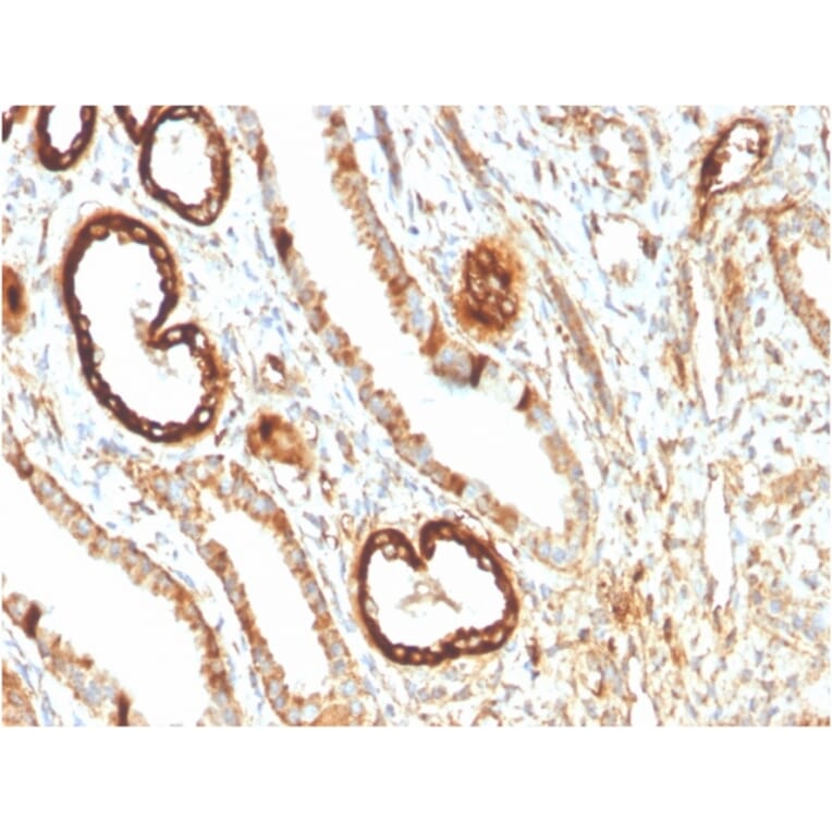 Immunohistochemistry - Anti-FABP1 Antibody [FABP1/3483] (A248517) - Antibodies.com