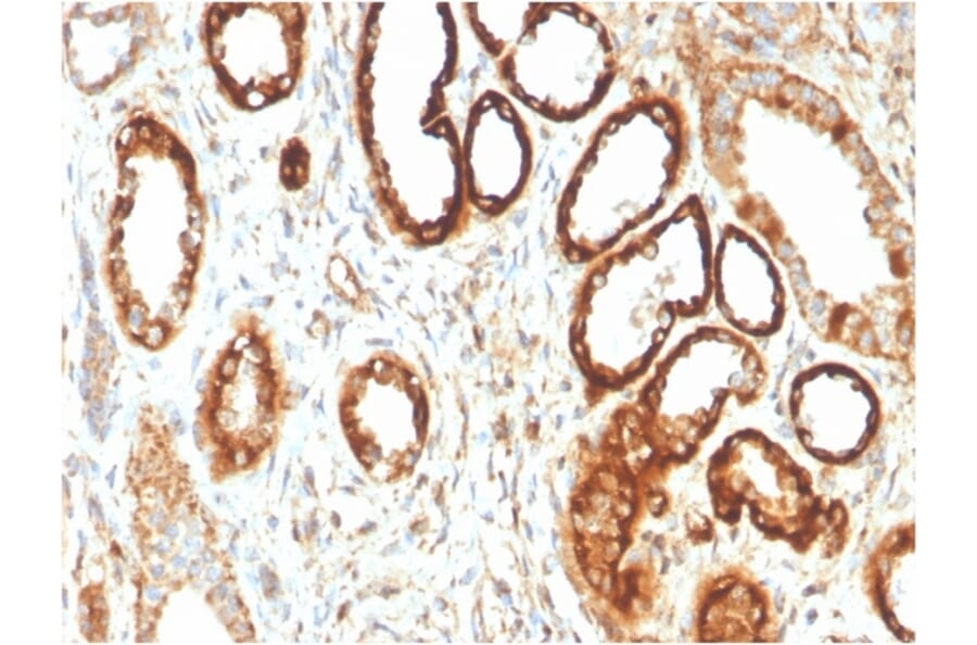 Immunohistochemistry - Anti-FABP1 Antibody [FABP1/3483] (A248517) - Antibodies.com