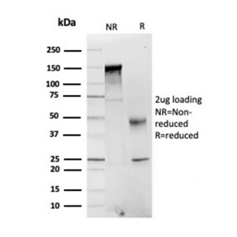 SDS-PAGE - Anti-FABP1 Antibody [FABP1/3484] (A248518) - Antibodies.com