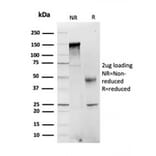 SDS-PAGE - Anti-FABP1 Antibody [FABP1/3484] (A248518) - Antibodies.com