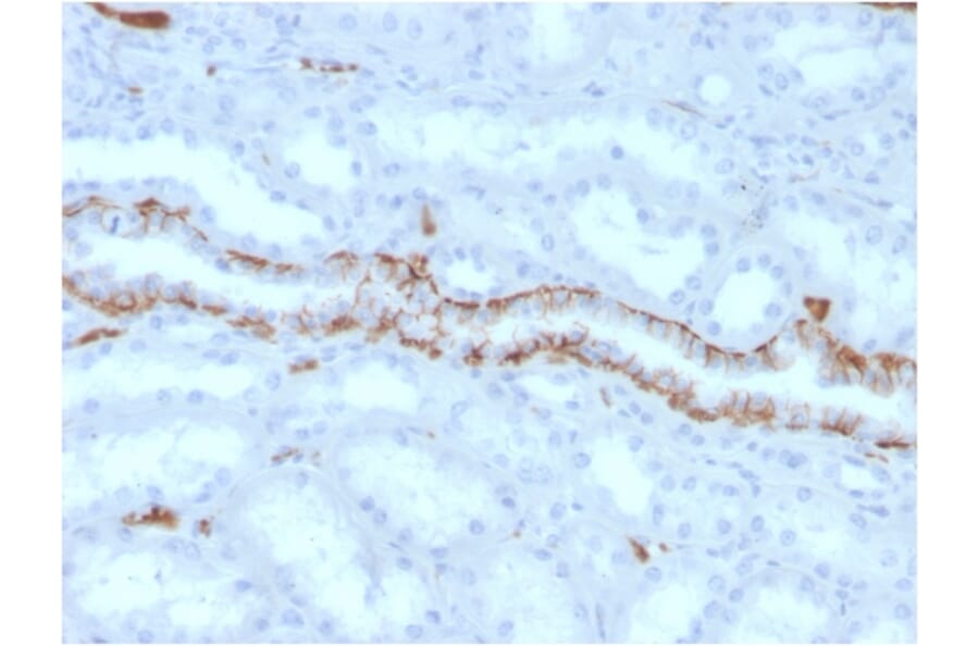 Immunohistochemistry - Anti-FABP1 Antibody [FABP1/3486] (A248519) - Antibodies.com