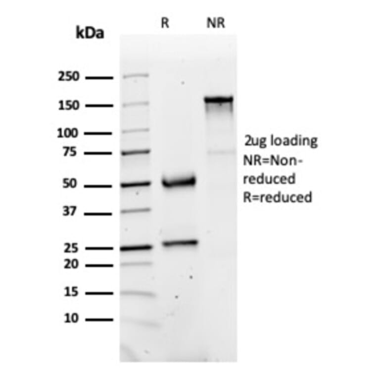 SDS-PAGE - Anti-FABP1 Antibody [FABP1/3486] (A248519) - Antibodies.com