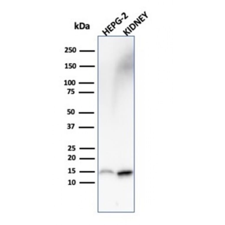 Western Blot - Anti-FABP1 Antibody [FABP1/3487] (A248520) - Antibodies.com