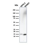 Western Blot - Anti-FABP1 Antibody [FABP1/3487] (A248520) - Antibodies.com