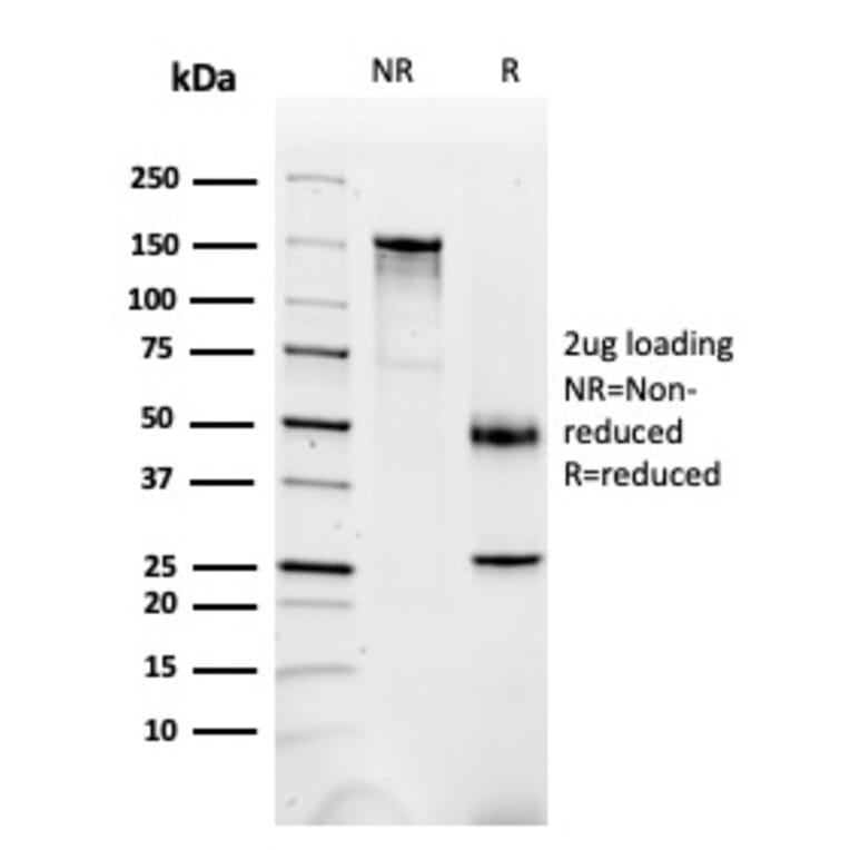 SDS-PAGE - Anti-FABP1 Antibody [FABP1/3487] (A248520) - Antibodies.com