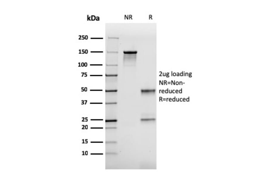 SDS-PAGE - Anti-FABP2 Antibody [CPTC-FABP2-3] (A248520) - Antibodies.com