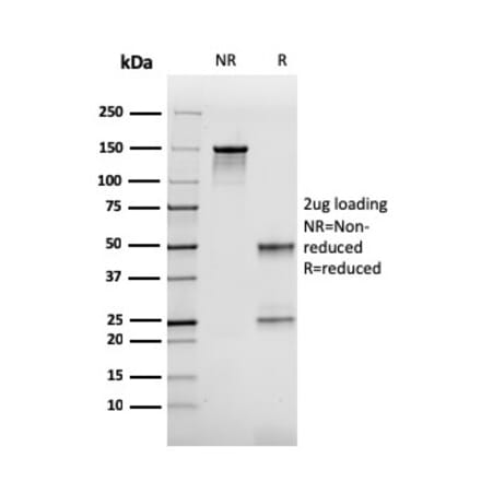 SDS-PAGE - Anti-FABP2 Antibody [CPTC-FABP2-3] (A248520) - Antibodies.com