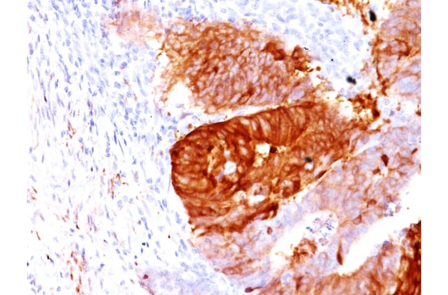 Immunohistochemistry - Anti-ALDH1A1 Antibody [ALDH1A1/1381] (A248521) - Antibodies.com
