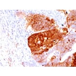 Immunohistochemistry - Anti-ALDH1A1 Antibody [ALDH1A1/1381] (A248521) - Antibodies.com