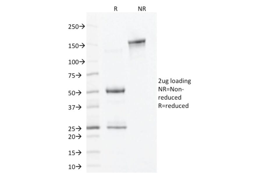 SDS-PAGE - Anti-ALDH1A1 Antibody [ALDH1A1/1381] (A248522) - Antibodies.com