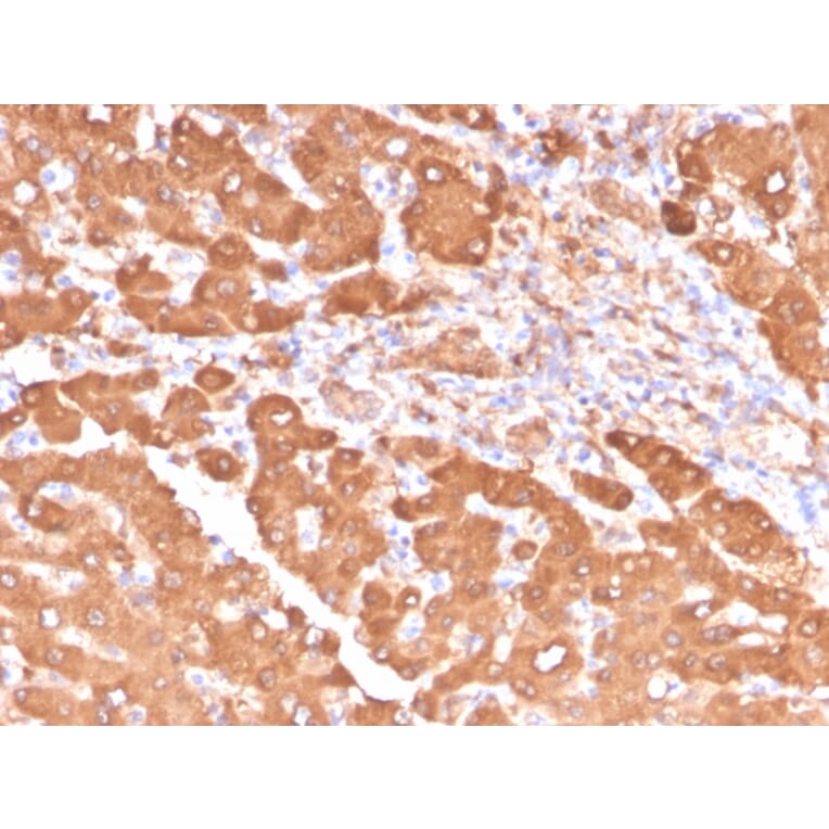 Immunohistochemistry - Anti-ALDH1A1 Antibody [ALDH1A1/4793] (A248523) - Antibodies.com