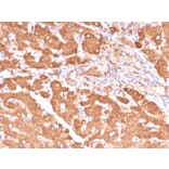 Immunohistochemistry - Anti-ALDH1A1 Antibody [ALDH1A1/4793] (A248523) - Antibodies.com